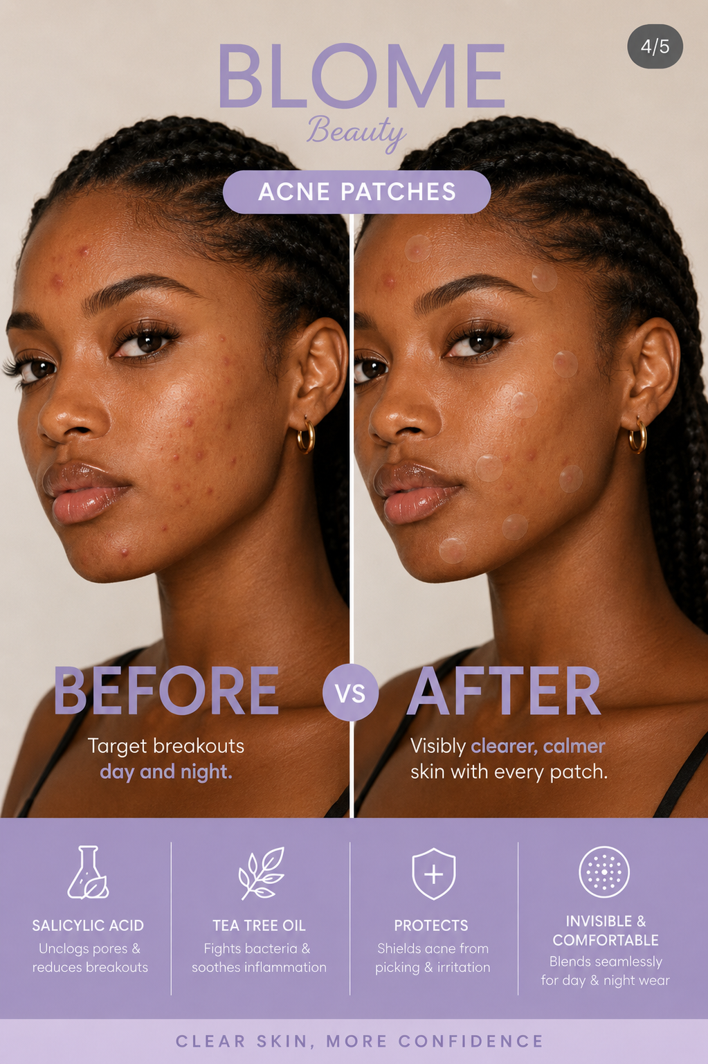 BLOME Beauty Acne Patches - 180 Hydrocolloid Acne Pimple Patches with Tea Tree Oil and Salicylic Acid