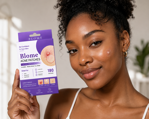 BLOME Beauty Acne Patches - 180 Hydrocolloid Acne Pimple Patches with Tea Tree Oil and Salicylic Acid